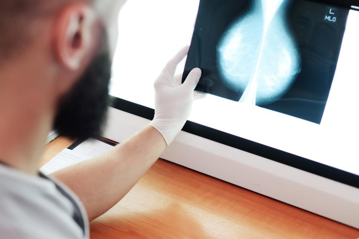 Análisis de una mamografía.