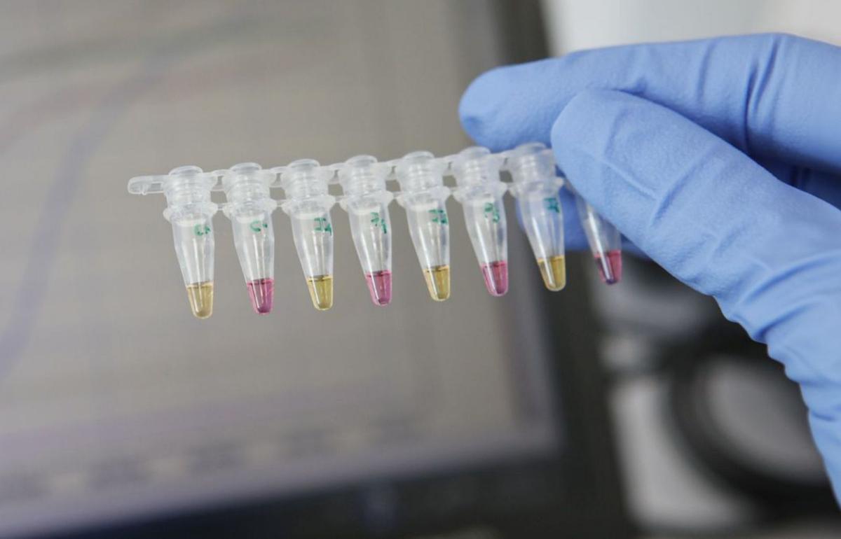 Die Firma GenoMi aus Mallorca hat einen schnellen PCR-Test entwickelt.