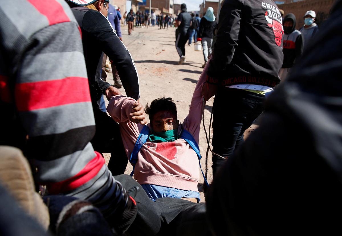Un hombre herido durante un enfrentamiento con las fuerzas de seguridad, durante una protesta exigiendo elecciones anticipadas y la liberación del expresidente Pedro Castillo.