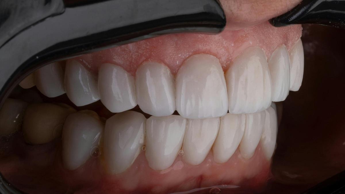 El truco de los dentistas para eliminar el sarro de los dientes en casa