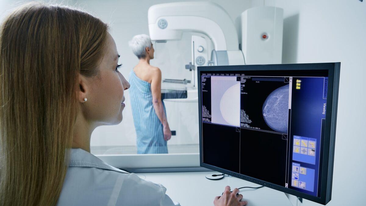 El cáncer de mama sigue siendo el tumor más frecuente entre las mujeres en España