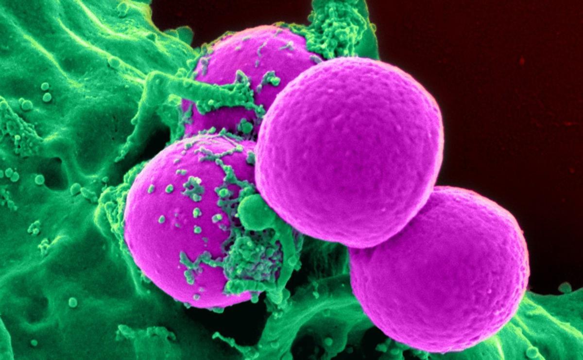 Las bacterias resistentes serán el siguiente gran problema de alud pública