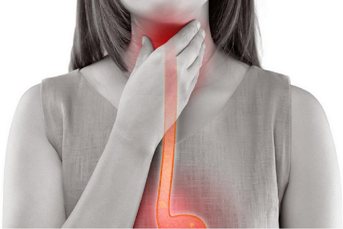 ¿Qué es la esofagitis eosinofílica?