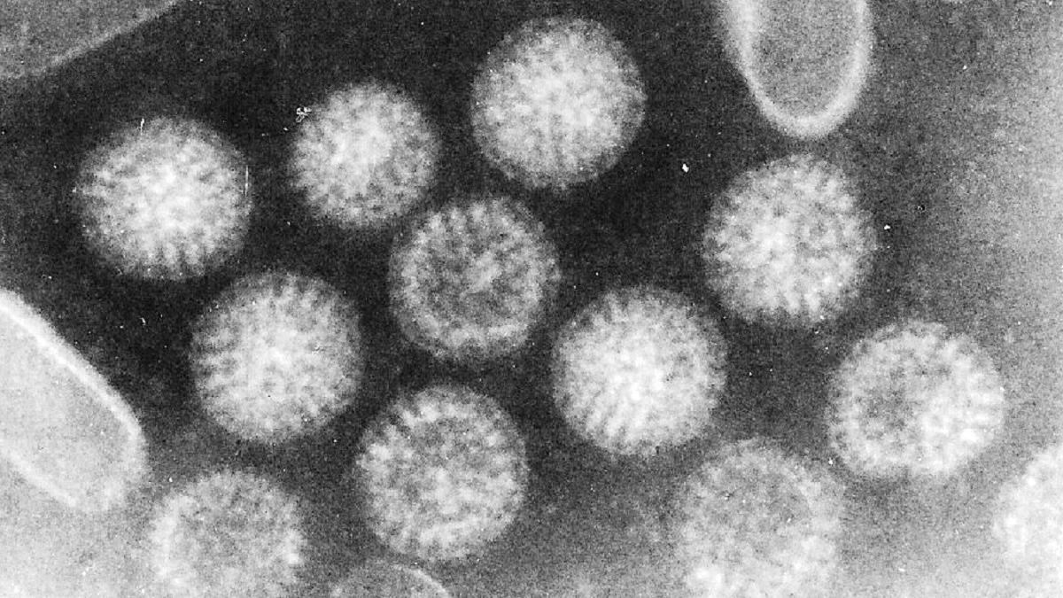 Los rotavirus son la causa más frecuente de gastroenteritis aguda infantil.