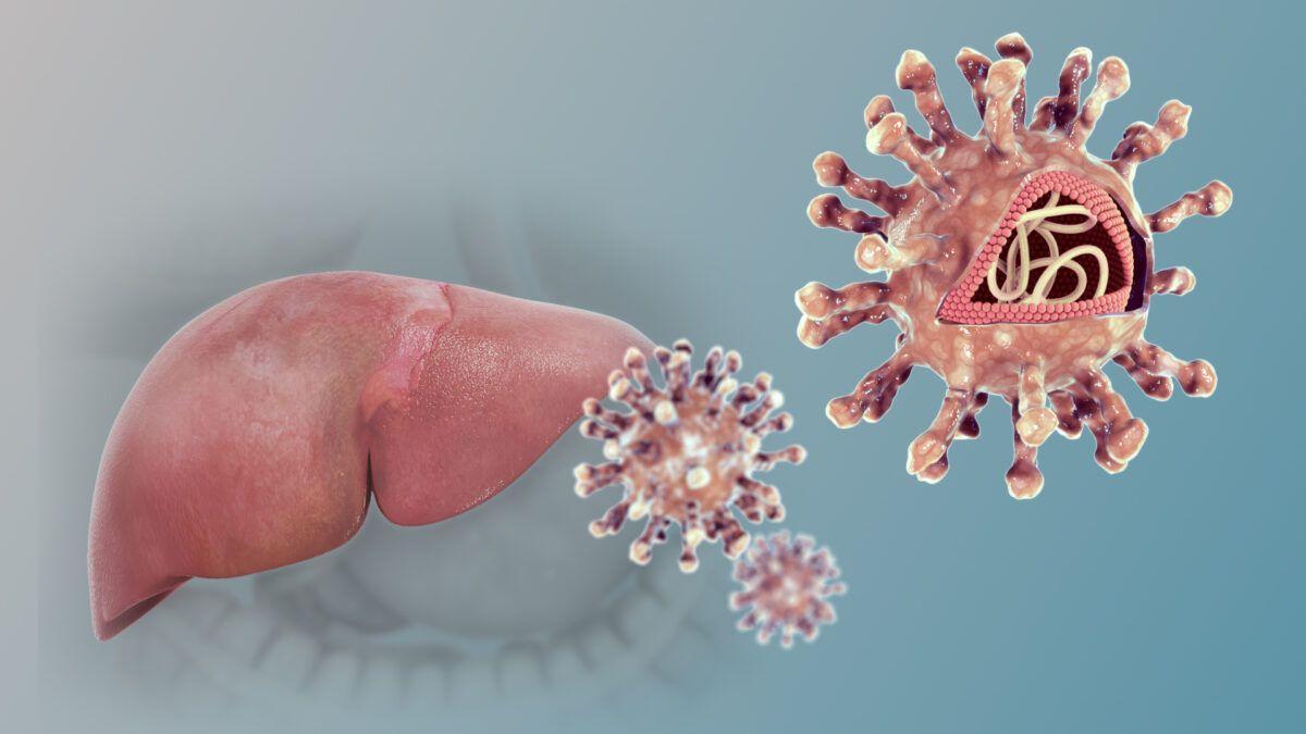 Día Mundial contra la Hepatitis Vírica: el tratamiento que conseguirá reducir al mínimo las complicaciones de esta infección