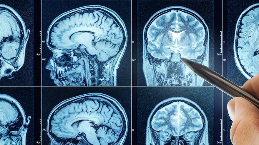 ¿Sabías que tu cerebro nunca descansa y consume tanta energí