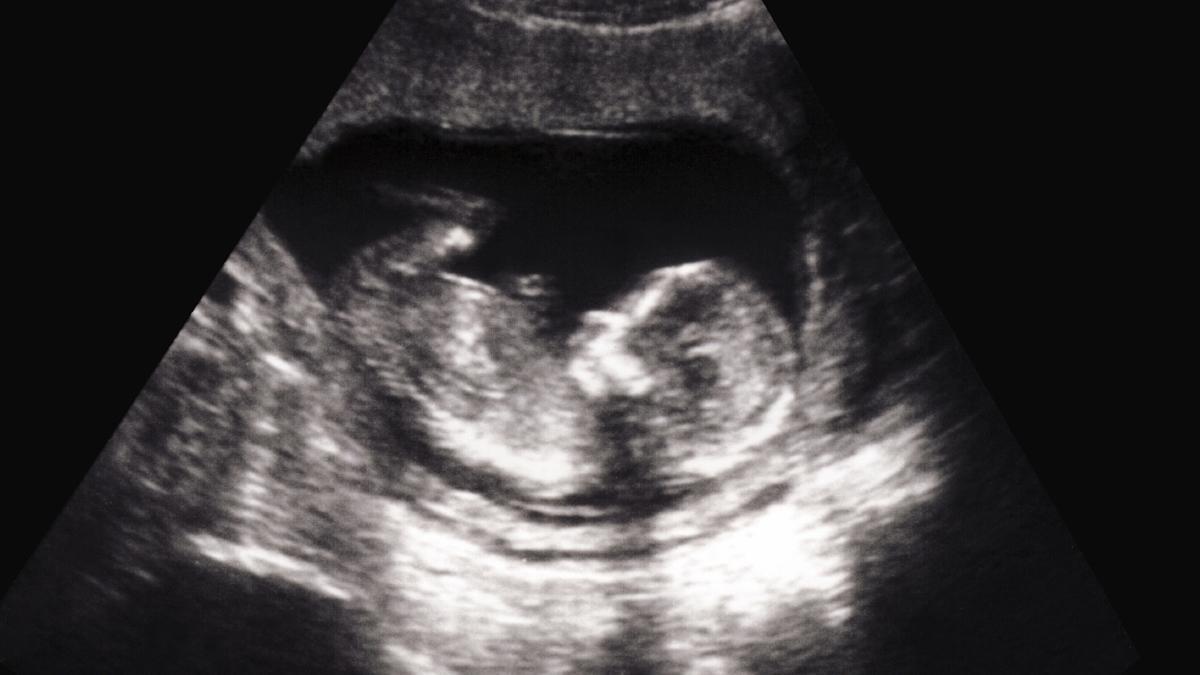 La transmissió de covid al fetus podria afectar el cervell i la memòria del nadó, segons un estudi