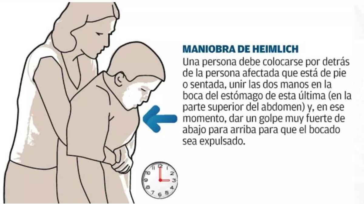 Maniobra de Heimlich