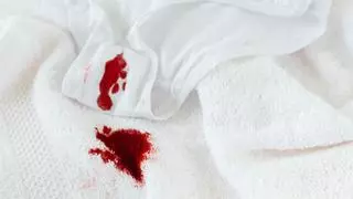 ¿Cómo quitar manchas de sangre en la ropa? Trucos para que tus prendas queden como nuevas