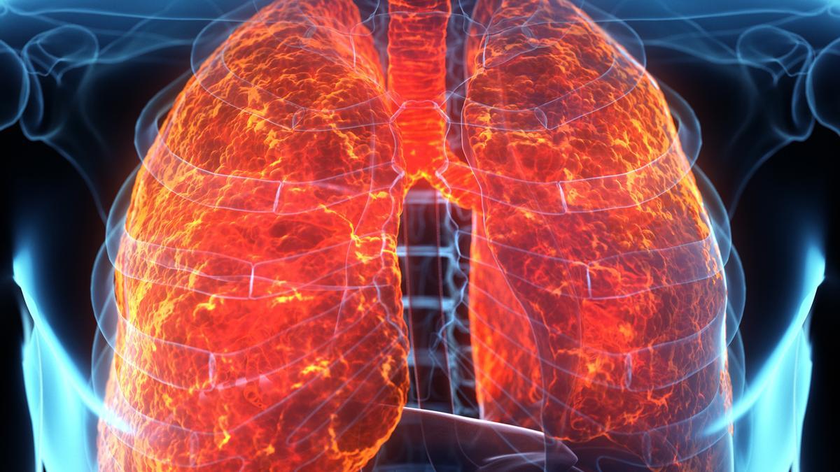 Los microplásticos han llegado a los pulmones