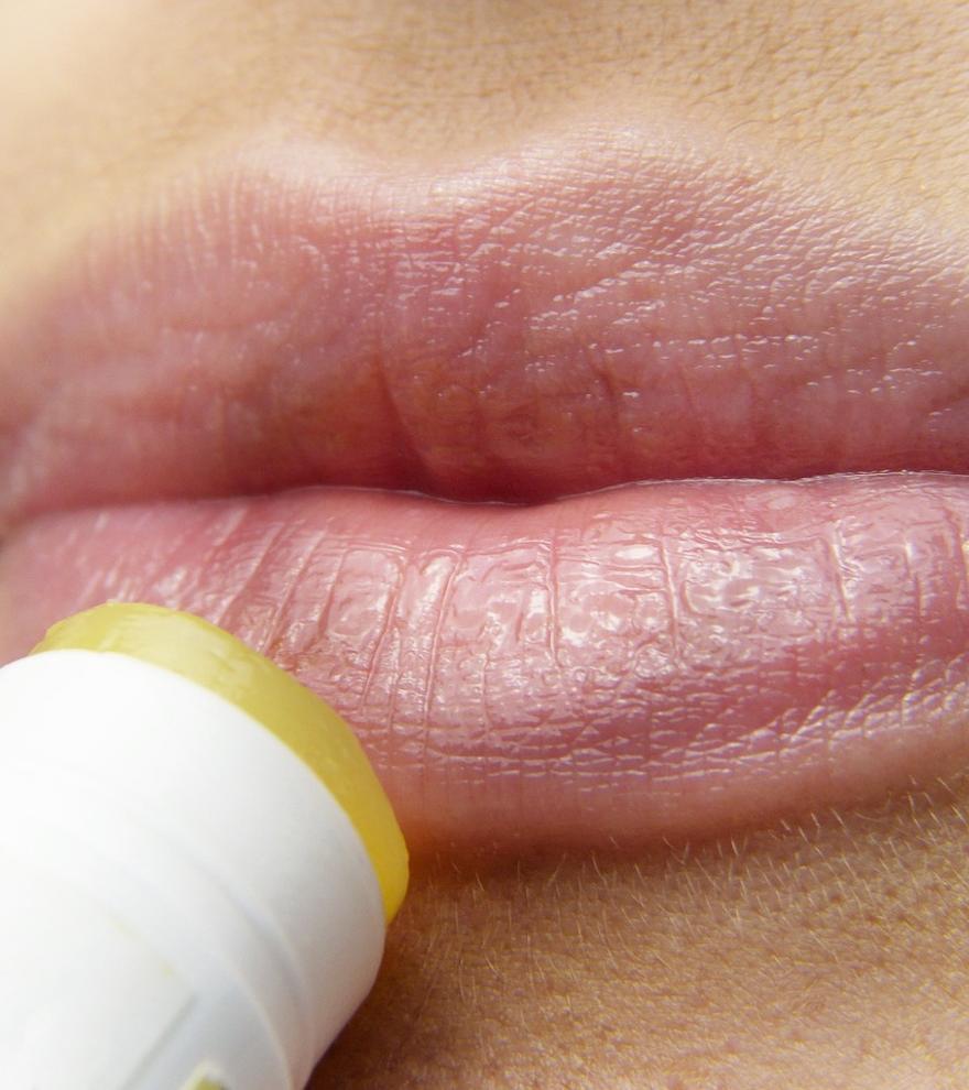 Calenturas o herpes labial: Síntomas y tratamiento de unas pupas muy dolorosas y contagiosas