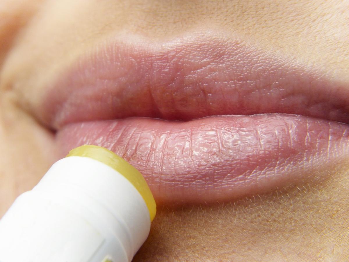 Herpes labial o calenturas, una dolencia frecuente e incómoda