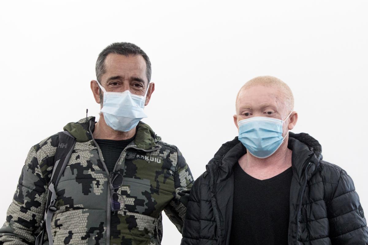 Cavadas reconstruye la cara a un paciente albino