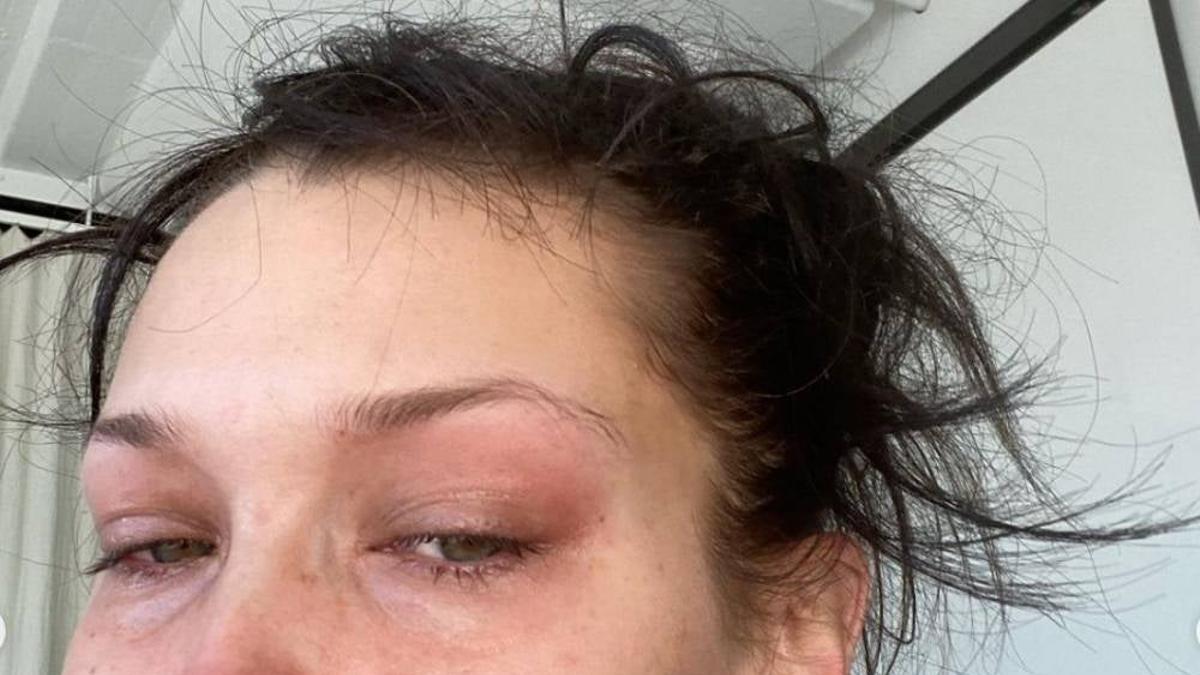 Bella Hadid llora cada noche por sus problemas de salud mental