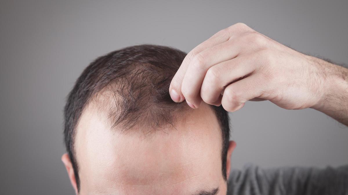 Este champú con cafeína previene la caída del cabello y arrasa en Amazon España.