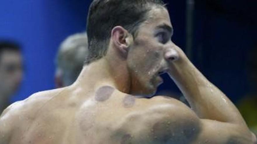 Los moratones de Michael Phelps en las Olimpiadas.