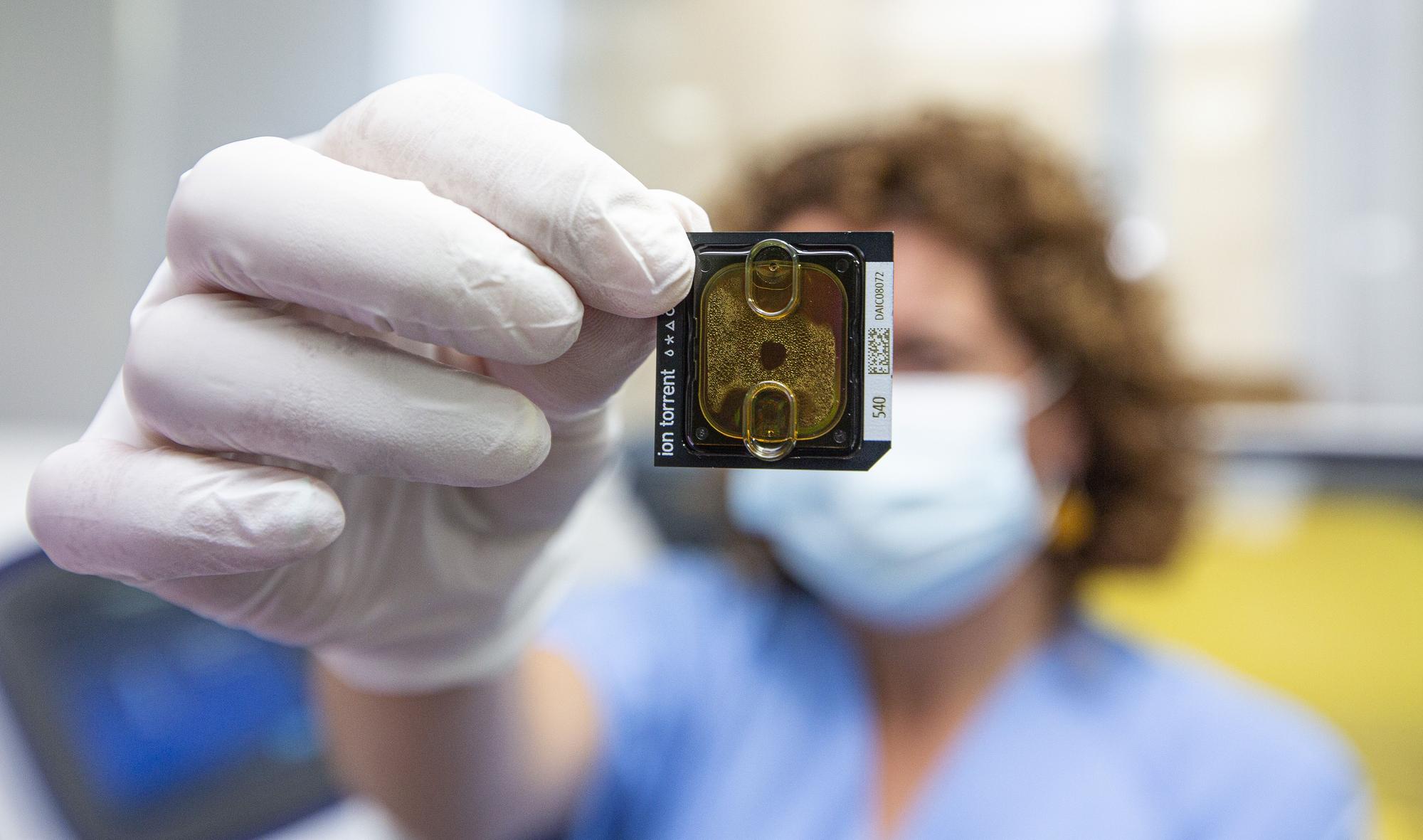 Una técnica que permite afinar en el diagnóstico del cáncer en el Hospital de Alicante