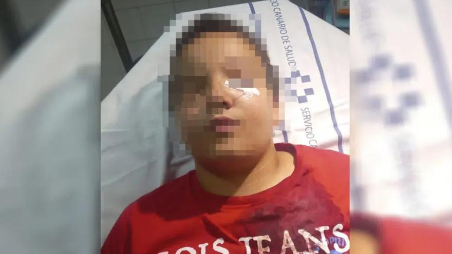 Una madre denuncia la agresión a su hijo de 11 años al defender a su abuelo en Tenerife