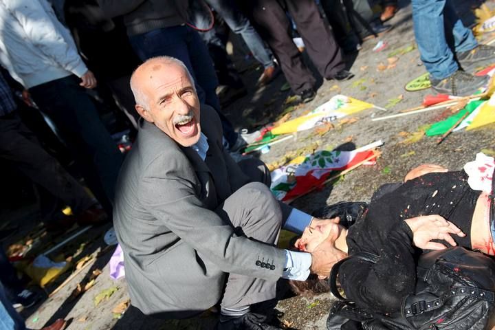 A man asks for help after an explosion during a peace march in Ankara