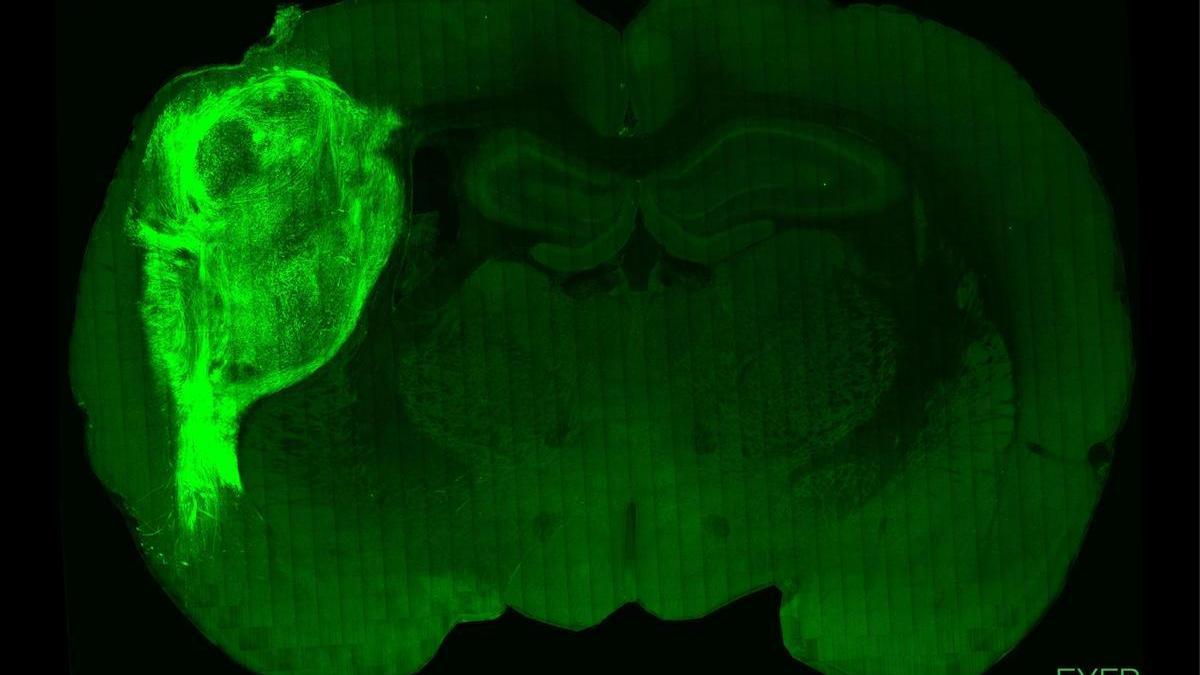 Imagen del ’minicerebro’ de células humanas transplantado a una rata.