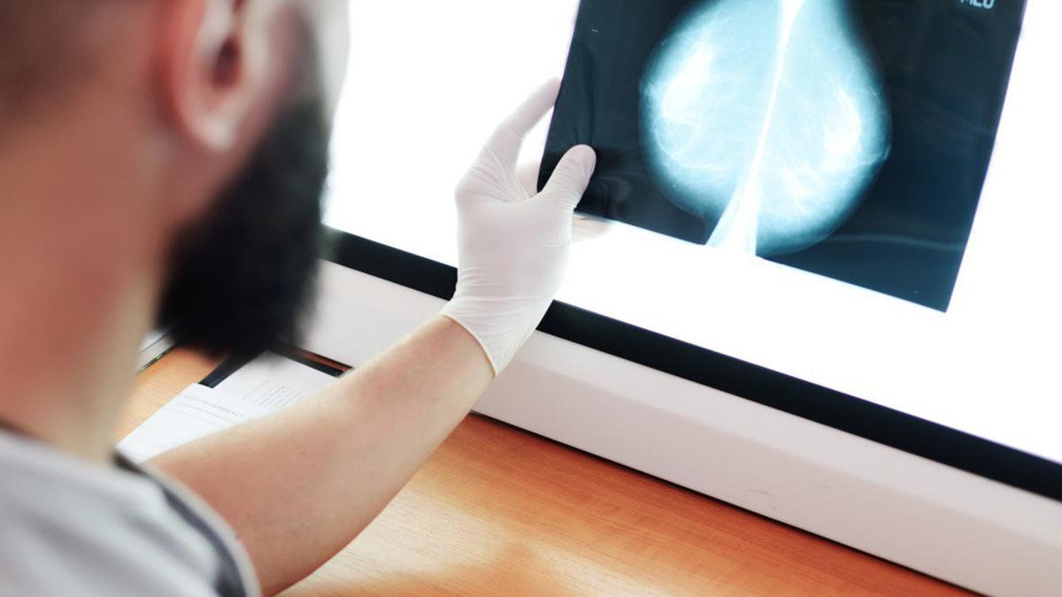 Análisis de una mamografía en un hospital.
