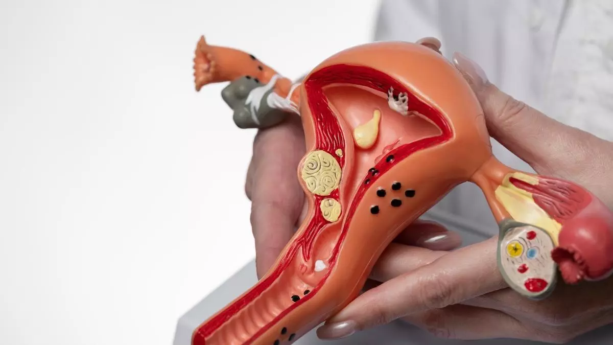 Un nuevo fármaco contra el cáncer de endometrio reduce un 32% el riesgo de muerte y abre una nueva vía de tratamiento