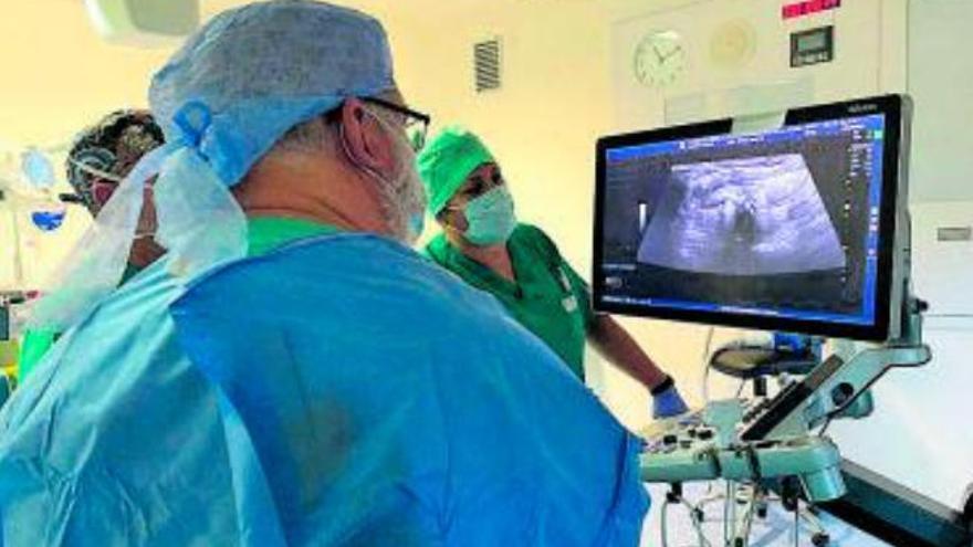 El Hospital Molina Orosa incorpora la radiofrecuencia para nódulos de tiroides
