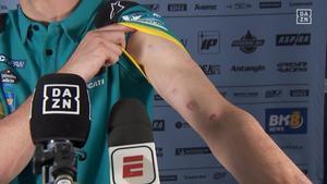 Así quedó el brazo de Àlex Márquez tras el GP de Brasil