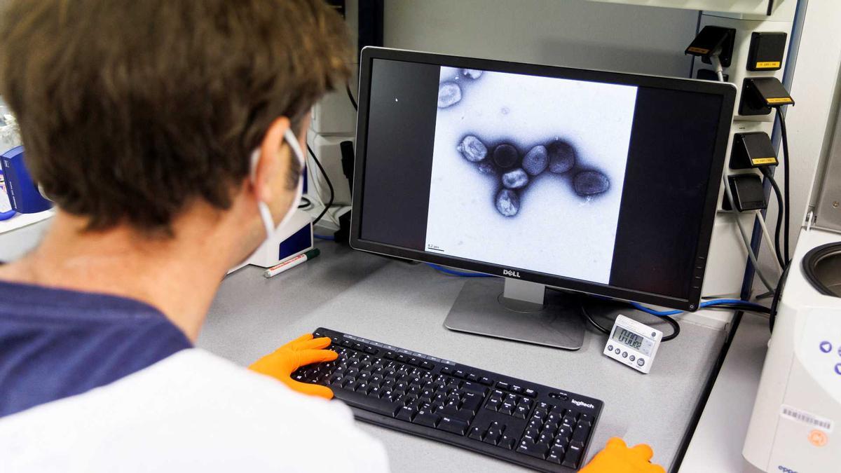 Un sanitari observa una imatge del virus de la verola del mico