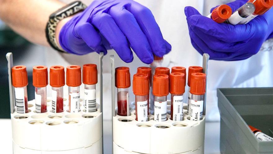 El Instituto de Biomedicina de Sevilla descubre características del VIH compatibles con su curación