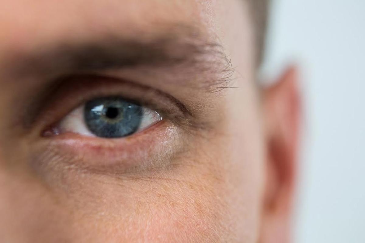 Nueve cada diez casos ceguera provocada glaucoma podrian
