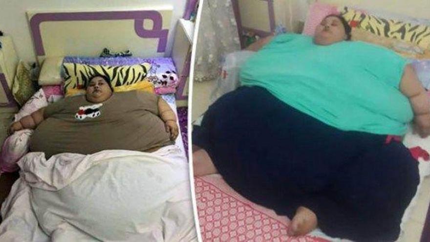 Solución para la mujer más gorda del mundo: pesa 500 kilos
