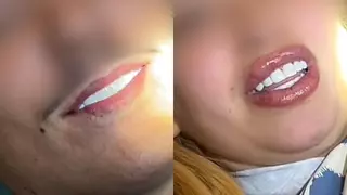 Carillas, vuelos y alojamiento por 1.250 euros: así funciona el turismo dental en Marruecos que advierten los dentistas españoles