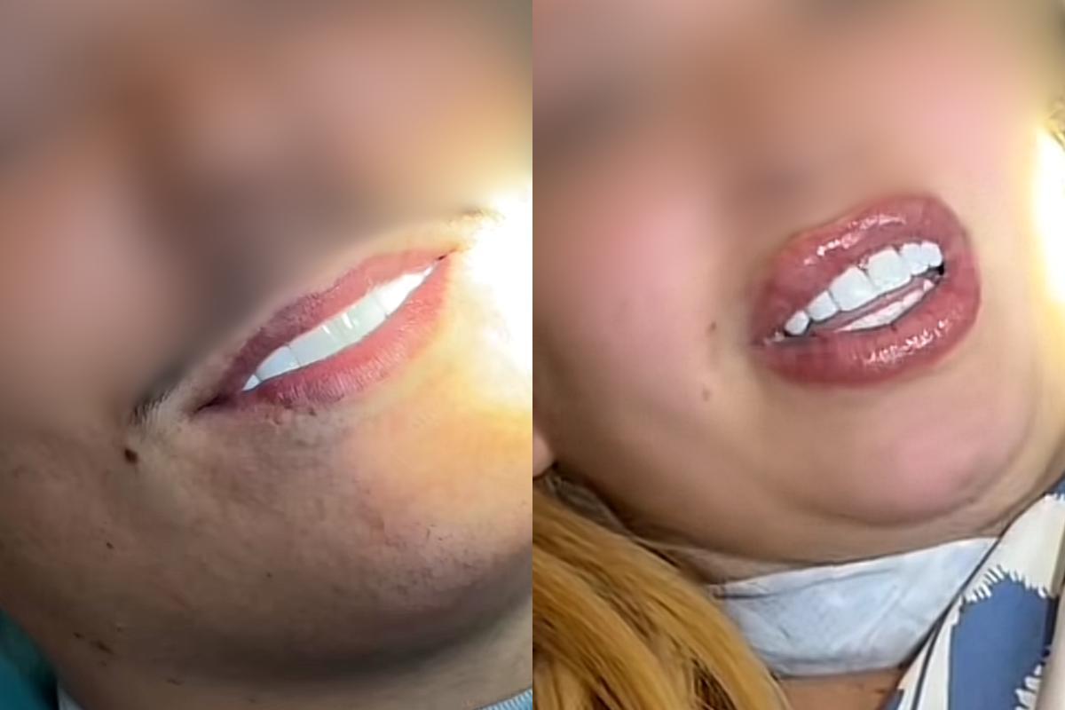 El Consejo General de Dentistas alerta sobre el turismo dental en Marruecos