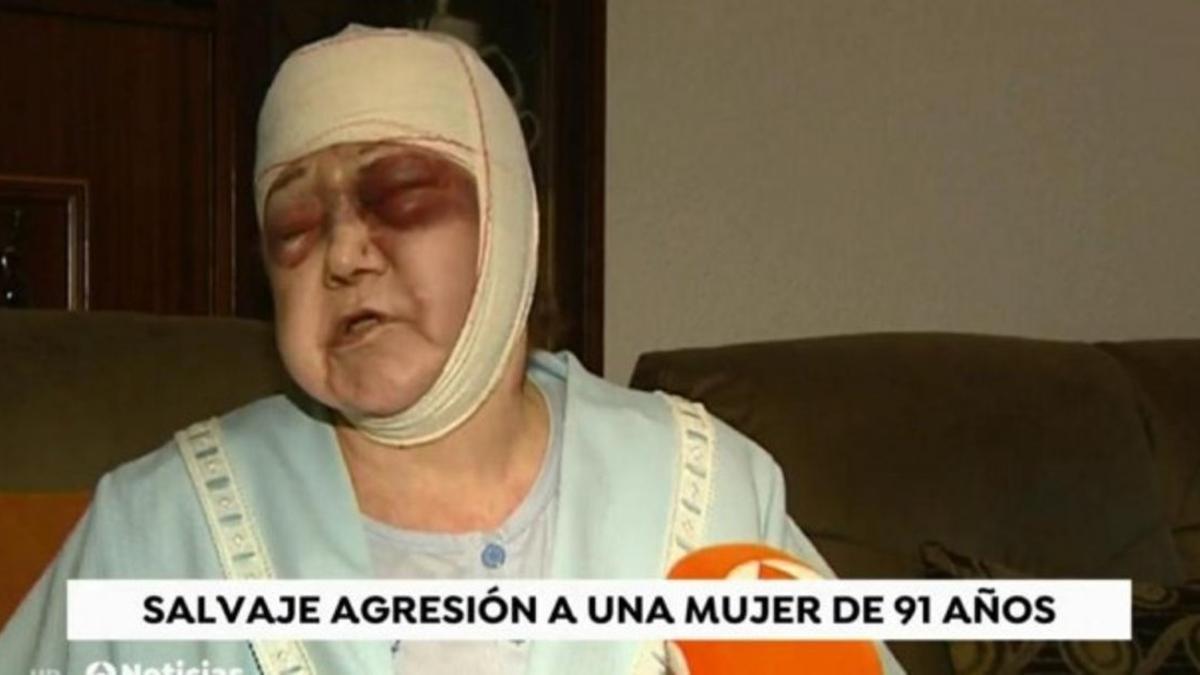 Brutal agresión a una mujer de 91 años en L'Hospitalet (Barcelona)