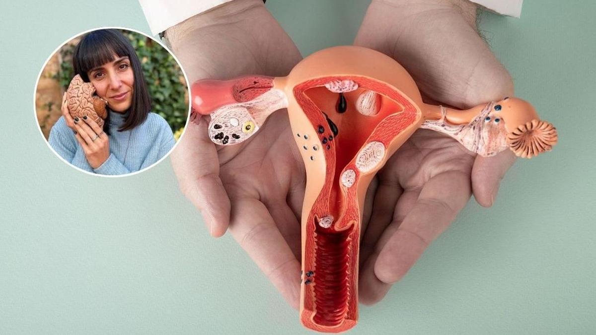 La endometriosis afecta al 10% - 20% de las mujeres en edad fértil