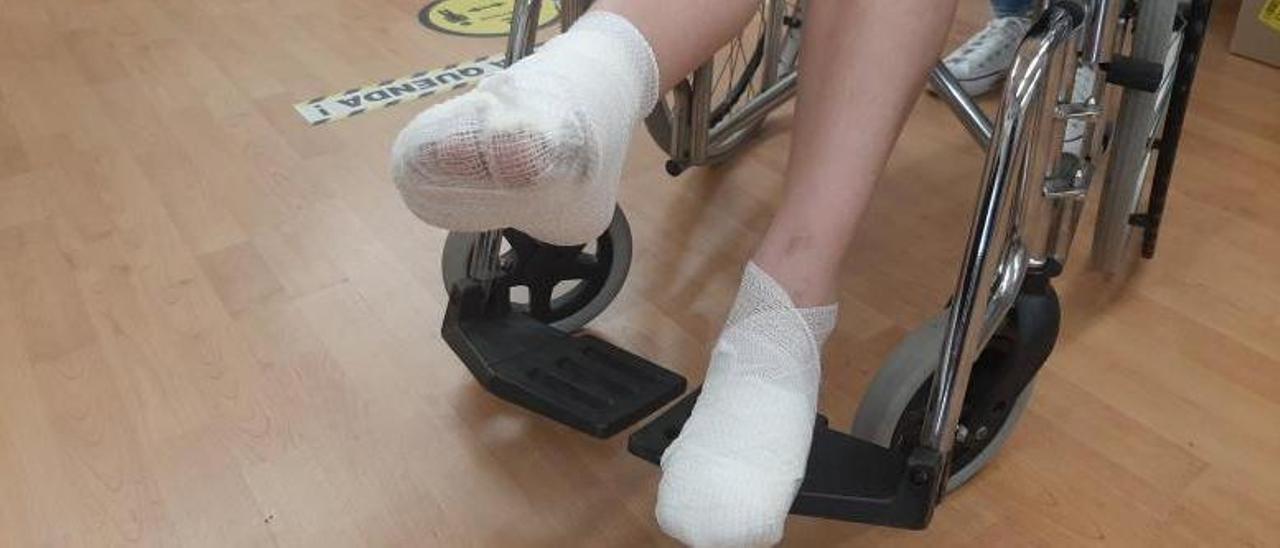 La joven ayer con los pies vendados en la silla de ruedas en la que se desplaza. | // FDV