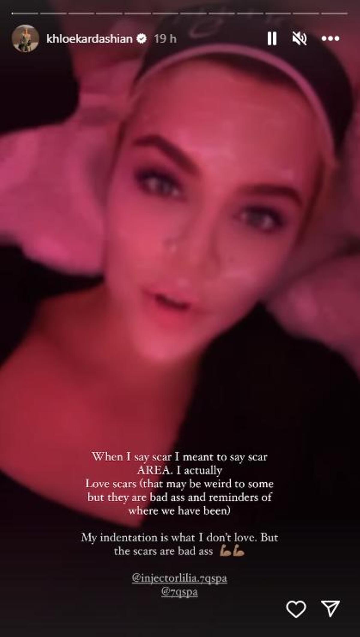 STORY KHLOE KARDASHIAN