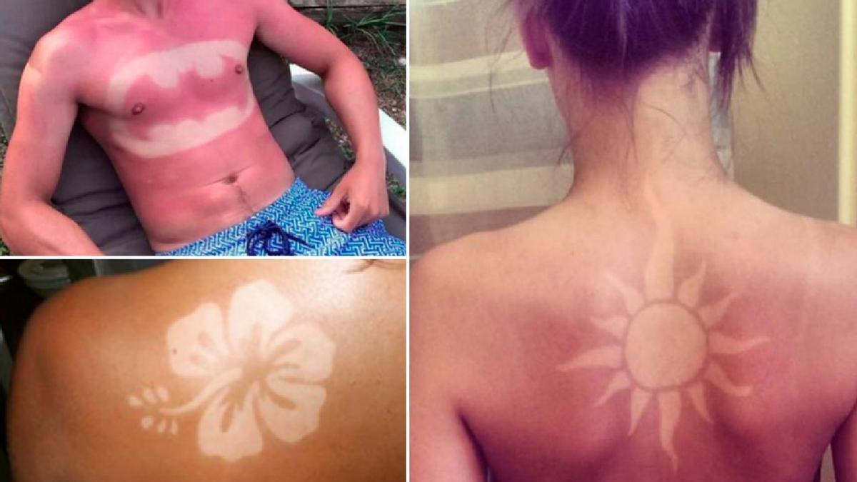 Tatuajes solares, una moda peligrosa.