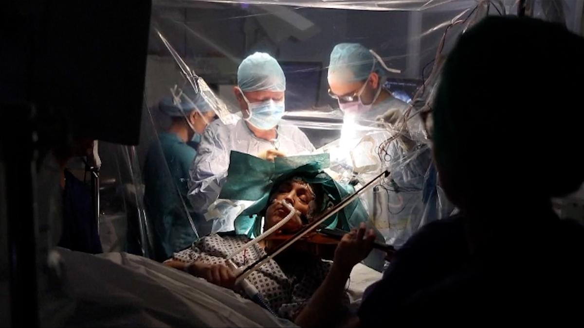 Una paciente toca el violín mientras le extraen un tumor cerebral0