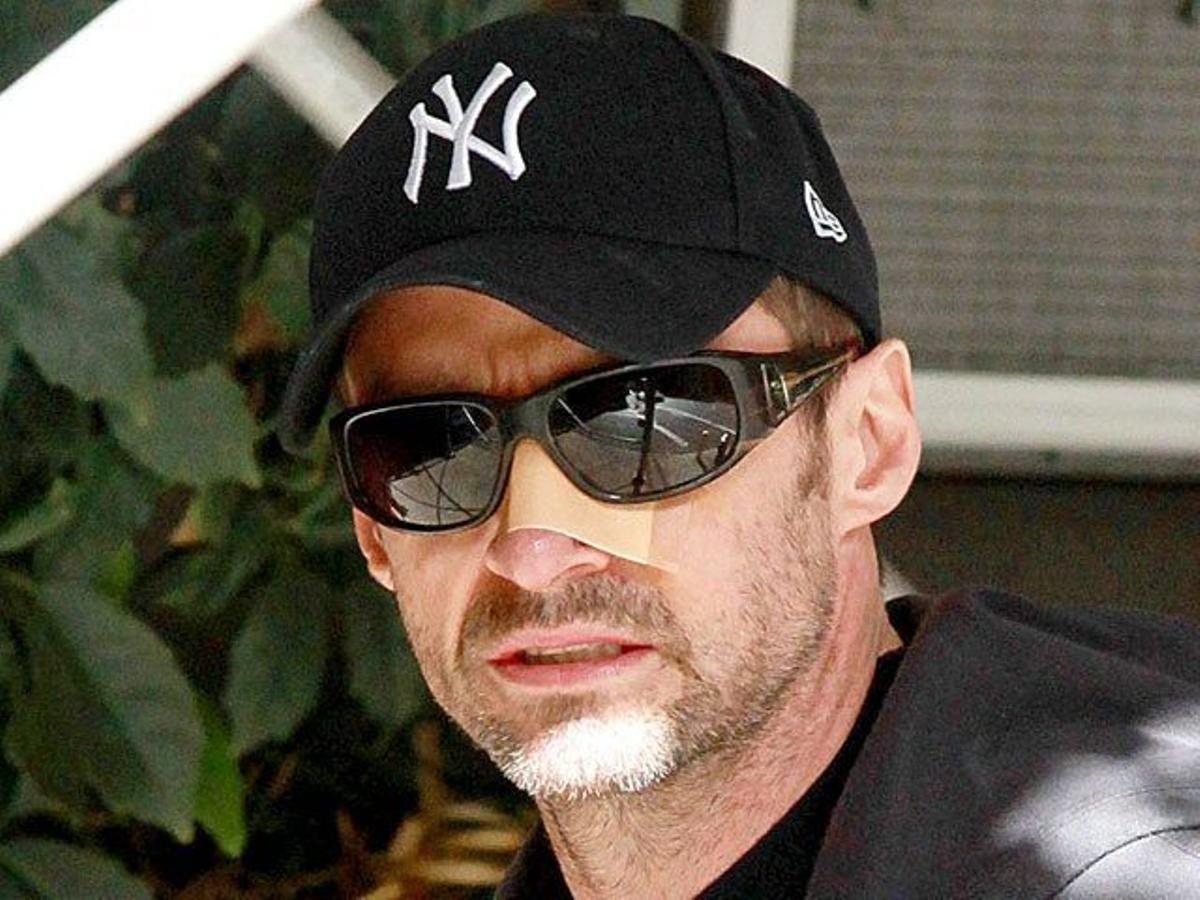 Hugh Jackman luce de nuevo una tirita en la nariz