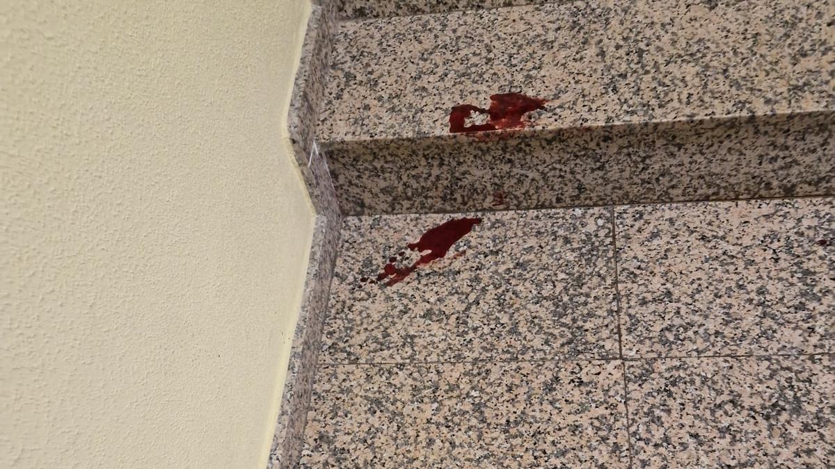 Sangre en las instalaciones del hotel de La Ribera, tras el suceso.