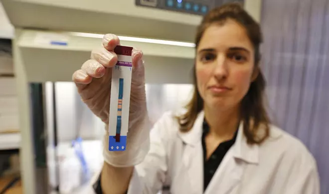 La detección de casos de VIH cae a la mitad al suprimirse consultas por la pandemia