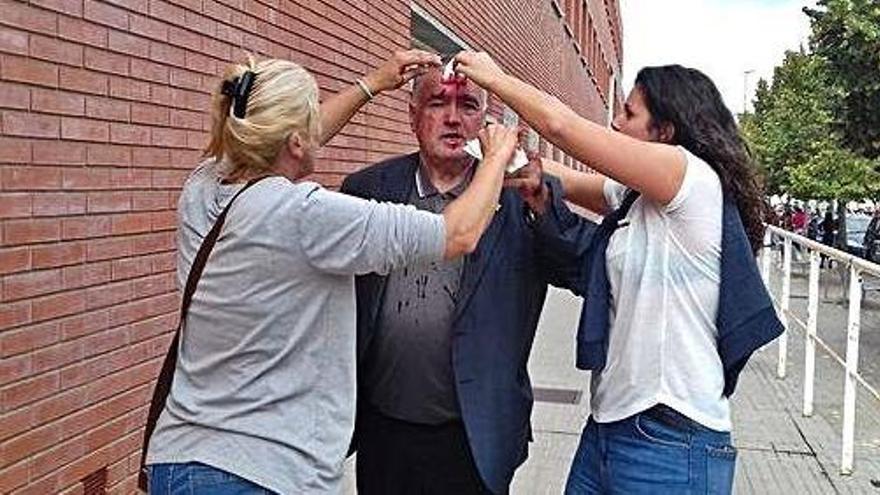 Concentrat al Quercus amb una ferida al cap el dia del referèndum