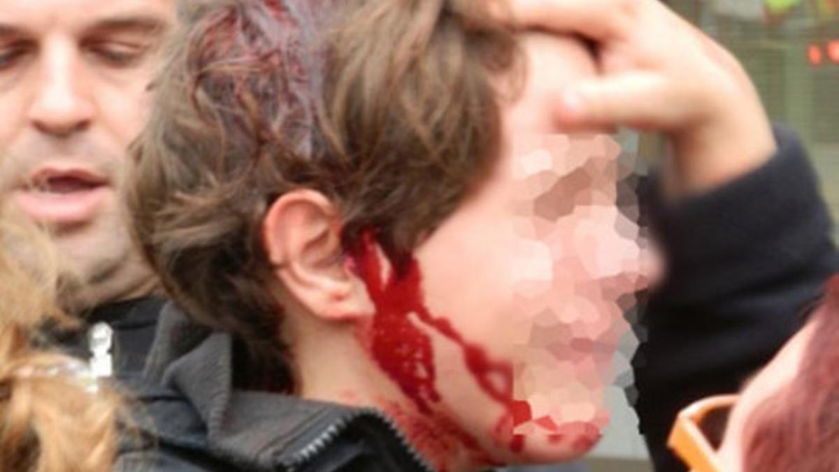 Foto del menor herido en Tarragona el pasado 14 de noviembre.