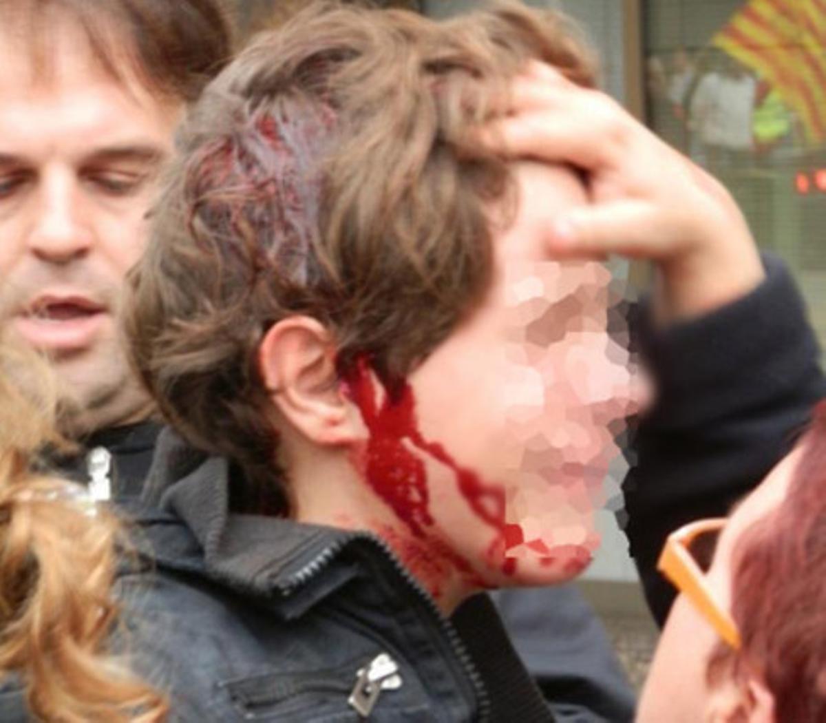 Foto del menor ferit a Tarragona el 14 de novembre passat.