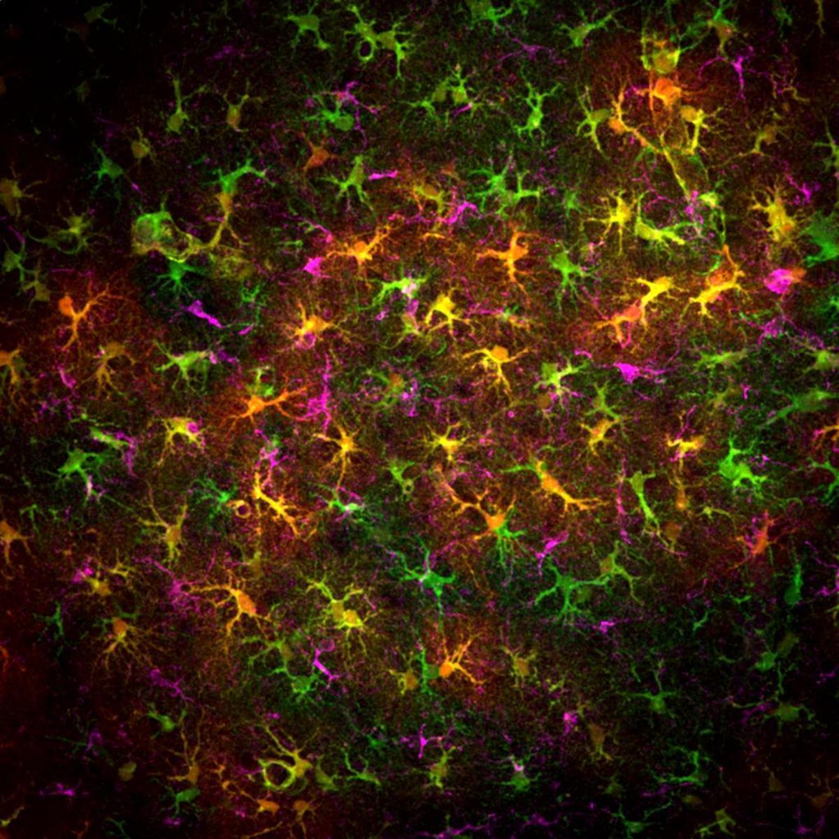 Astrocitos con las características prolongaciones en forma de estrella que dan nombre a estas células del cerebro