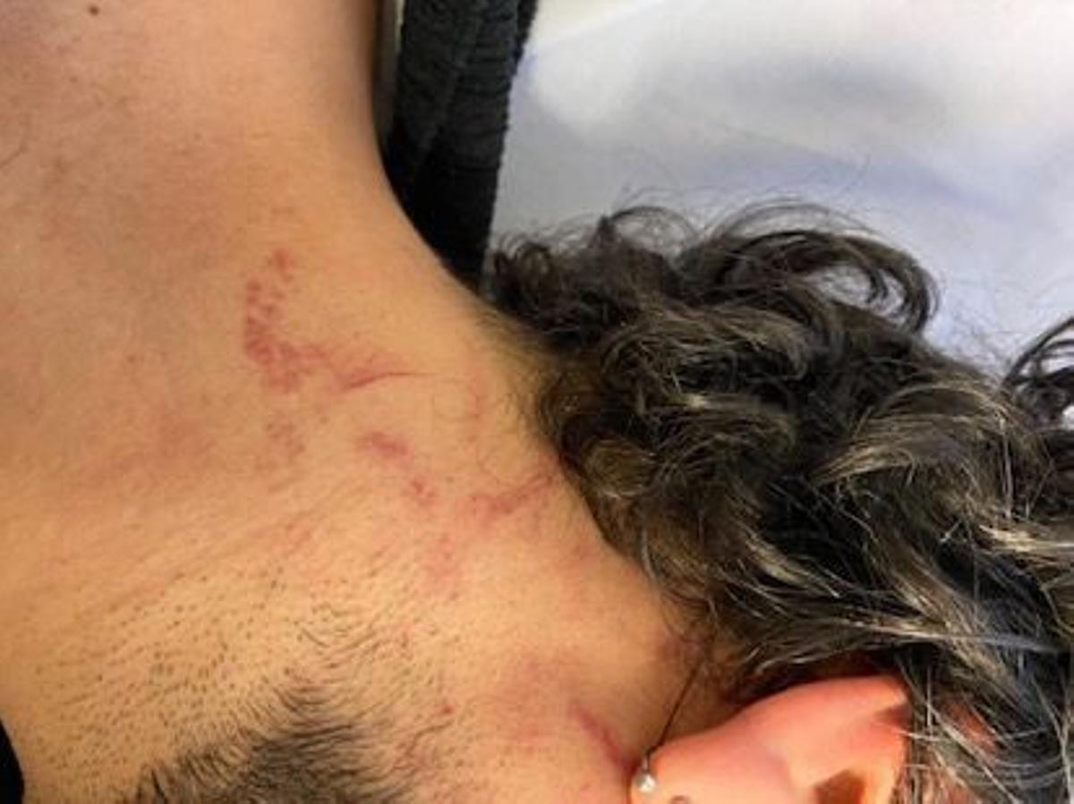 Imagen de la víctima de la agresión