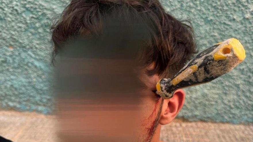 Un detenido por clavar un destornillador en la cabeza a un hombre durante una reyerta en Alicante