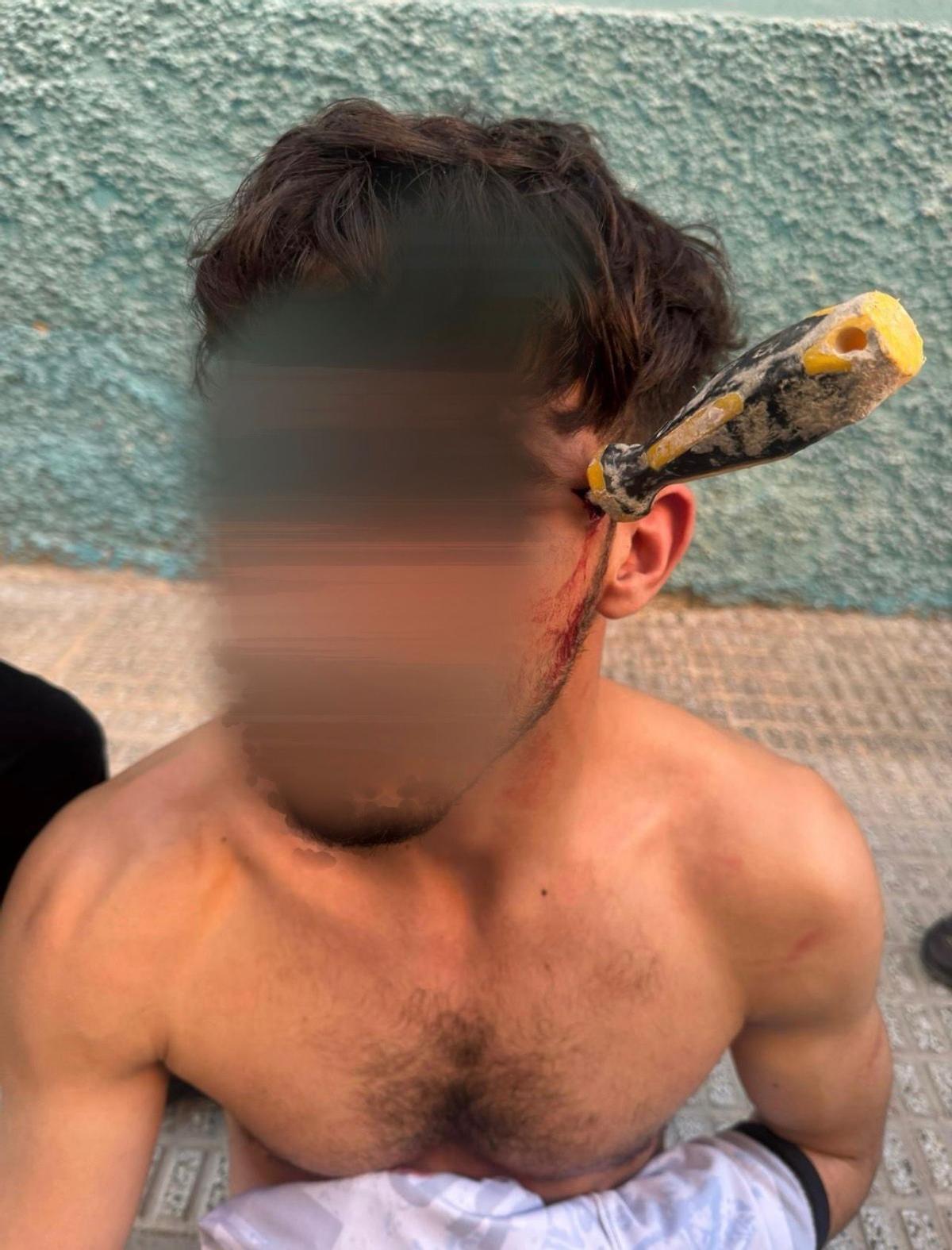 El herido con el destorinillador clavado en una imagen cedida.